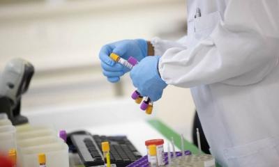 Maranhão ganha autonomia no diagnóstico molecular de arboviroses