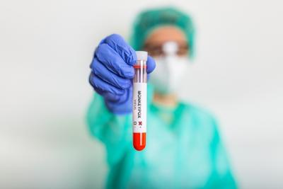 Maranhão recebe primeiro lote da vacina Monkeypox