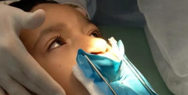 Sancionada lei que oferece cirurgia de lábio leporino pelo SUS